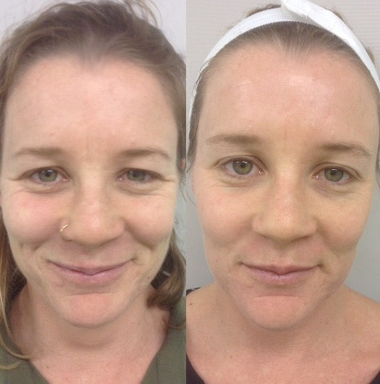 Legacy of Rage - Bundle